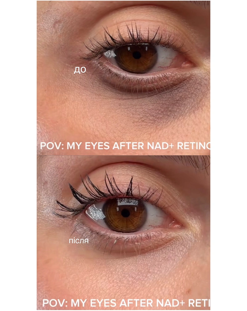 Ліфтинг-крем для зони навколо очей NUMBUZIN NO.9 NAD Retinol Volumetox Eye Cream, 10 мл