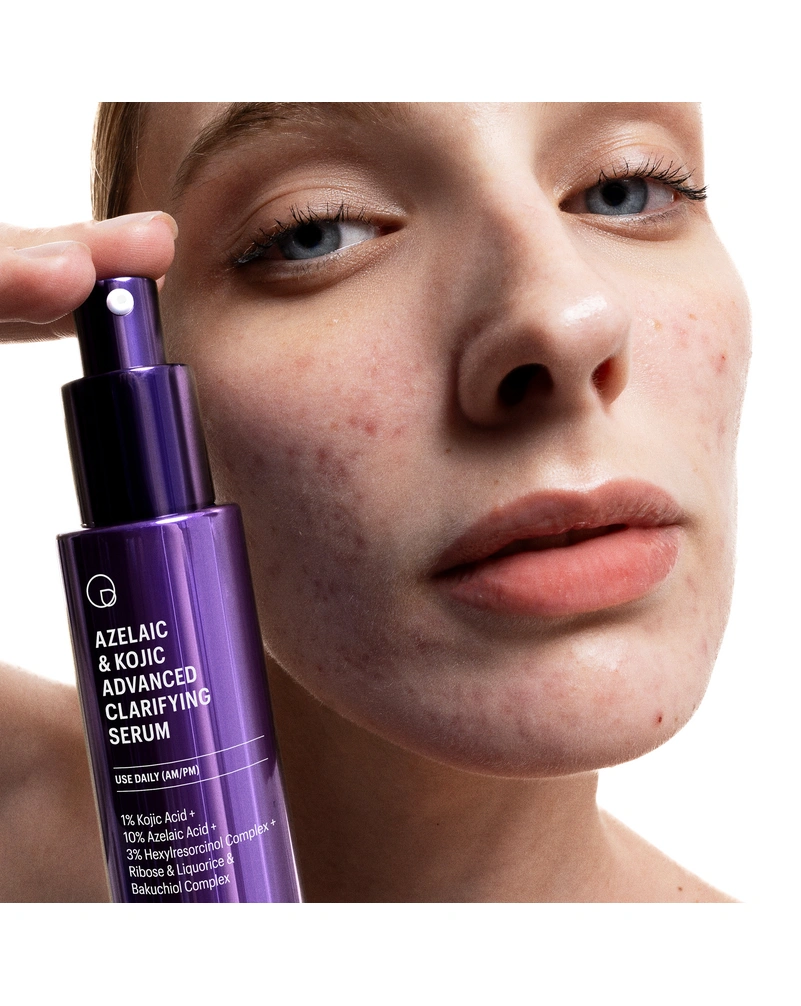 Осветительная сыворотка с азелаиновой кислотой Allies of Skin Azelaic & Kojic Advanced Clarifying Serum, 30 мл