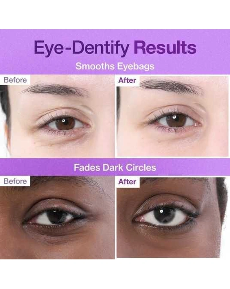 Патчі під очі Numbuzin Nad + Collagen Eye Patches, 5шт*8г