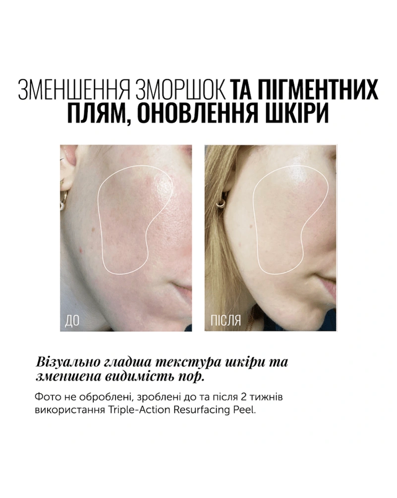 Пілінг для обличчя потрійної дії INSTYTUTUM Triple Action Resurfacing Peel, 60 мл