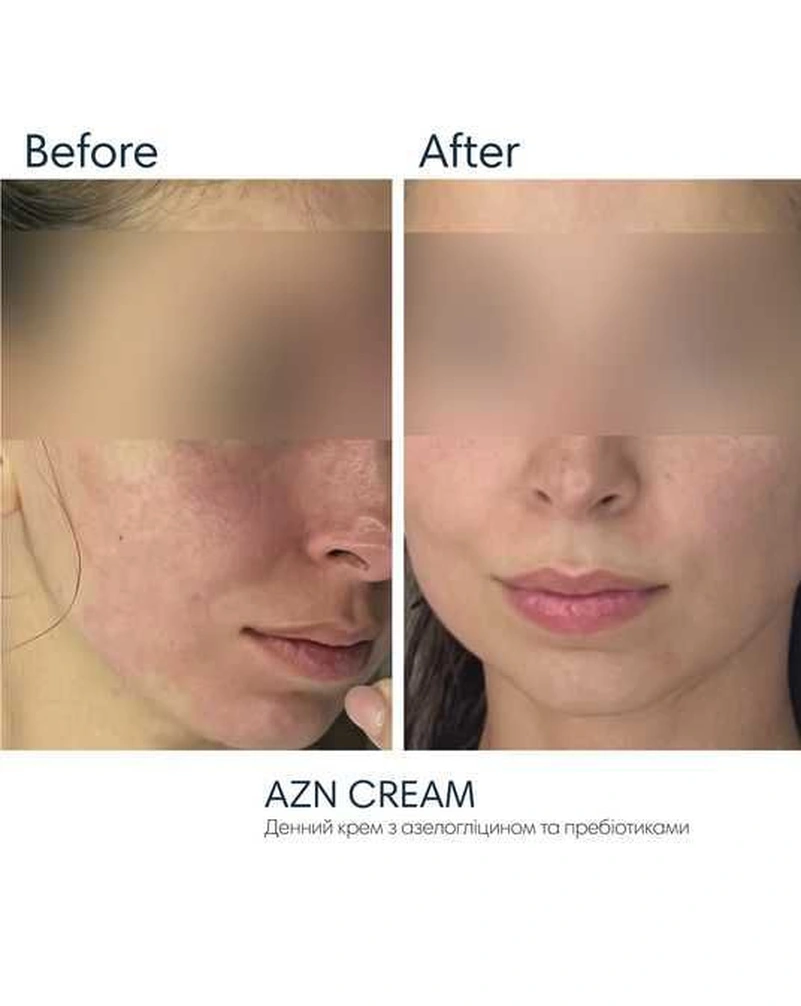 Сонцезахисний крем з протизапальним ефектом Braderm Azn Cream, 30 ml